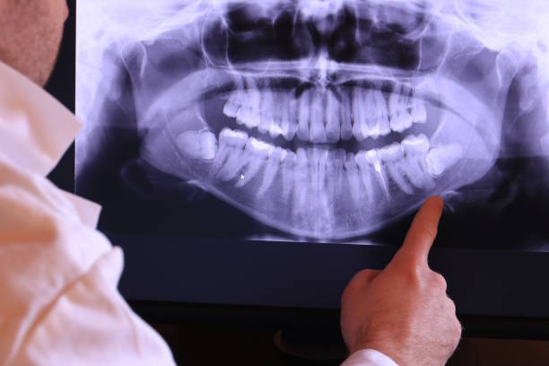 Best Emergency Broken Tooth Repair in Pilot Point, TX